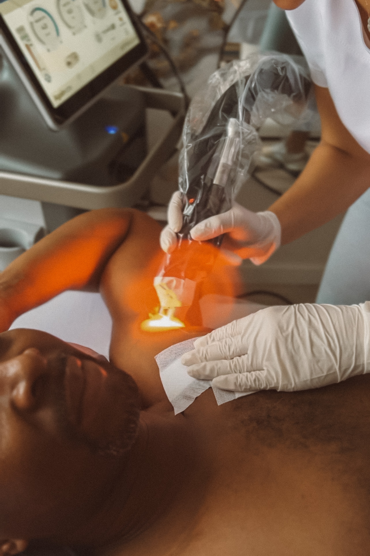 Laser usage